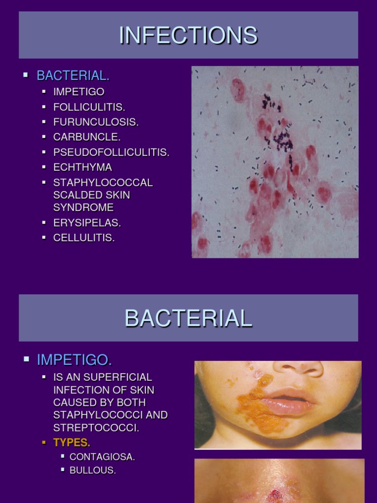 Bacterial Infection | PDF | Social Science | Wellness