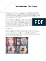 Perawatan Pulpotomi Pada Gigi