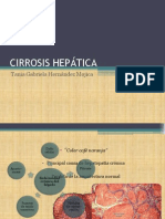 CIRROSIS HEPÁTICA