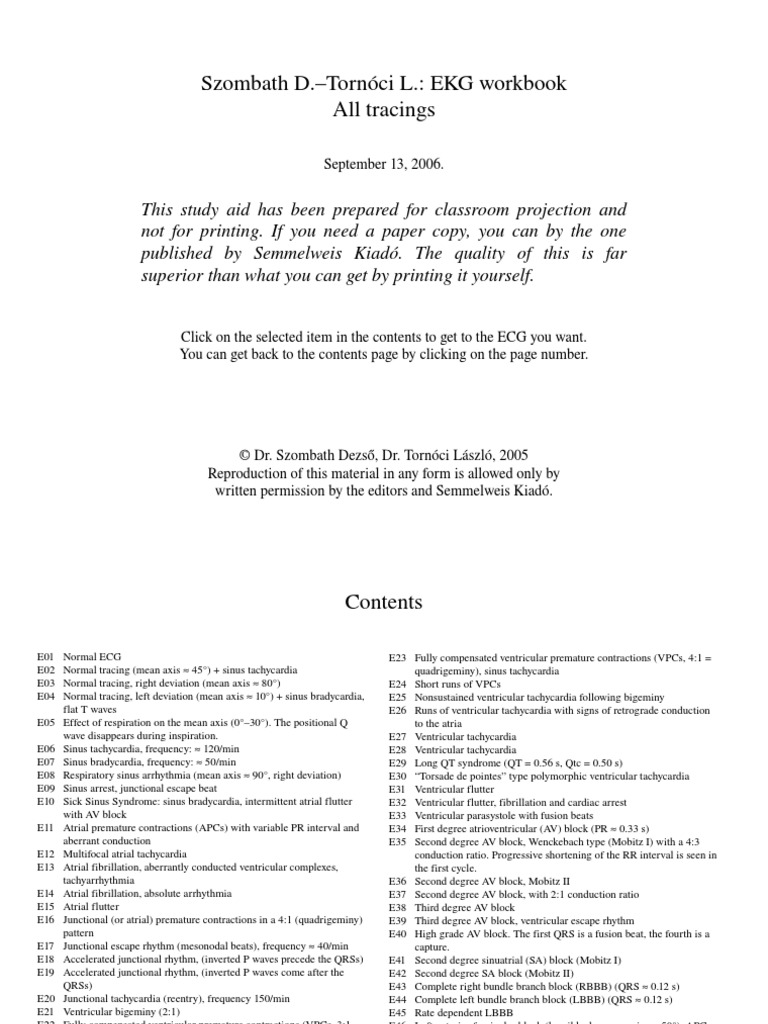 Exemplos de ECG | PDF | Visual Cortex | Electrocardiography