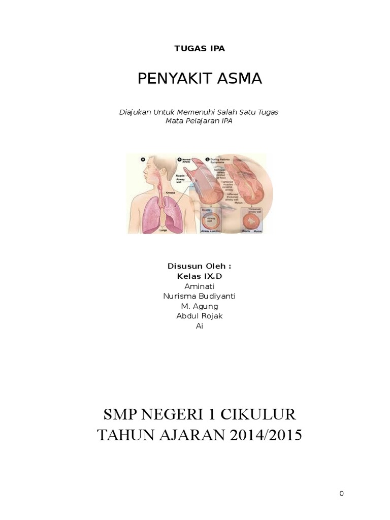 Artikel Asma
