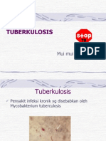 tuberkulosis ppt