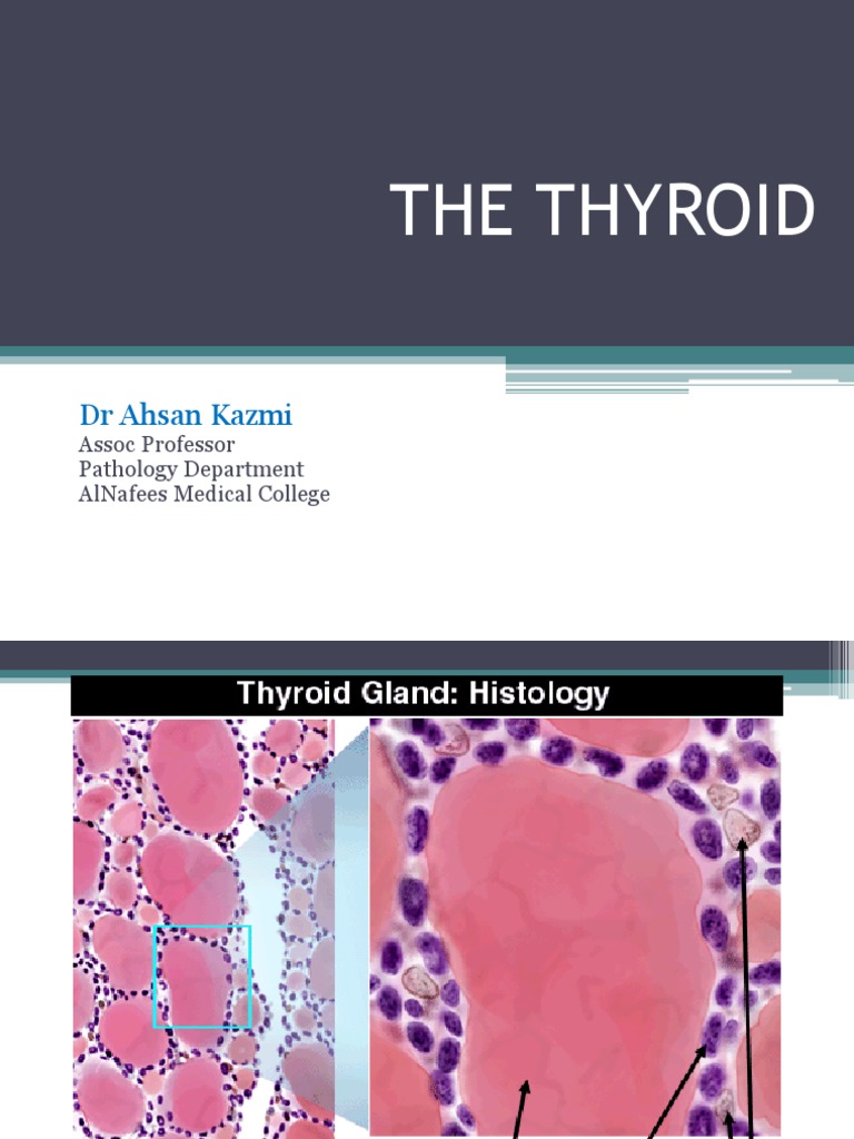 Pathology of Thyroid Gland | PDF | Thyroid | Hypothyroidism