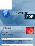 Gastritis