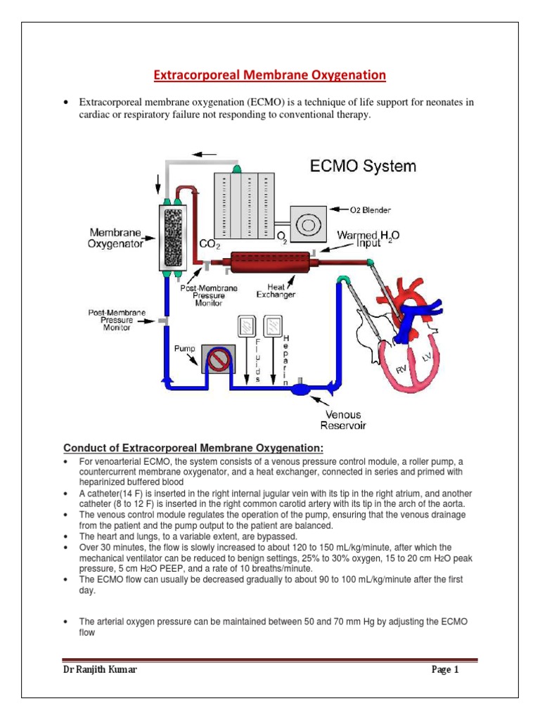 ECMO pdf Medical Specialties Cardiovascular System