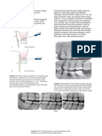 PERIO RADIOGRAFI