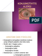 Konjungtivitis Alergi Power Point