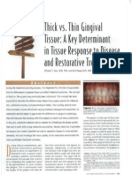 007_thick vs. Thin Gingival Tissue