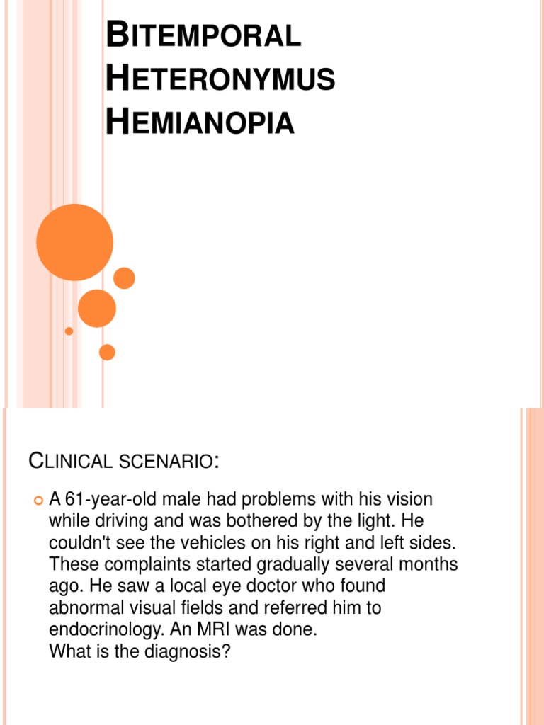 Bitemporal Heteronymus Hemianopia | PDF | Visual System | Animal Anatomy