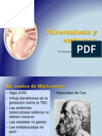 Tuberculosisyembarazo 140204210723 Phpapp01