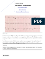 Analysis and Interpretation of the Electrocardiogram