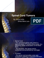 Spinal Cord Tumors: By: Divine Incillo Shiela Marie Lara