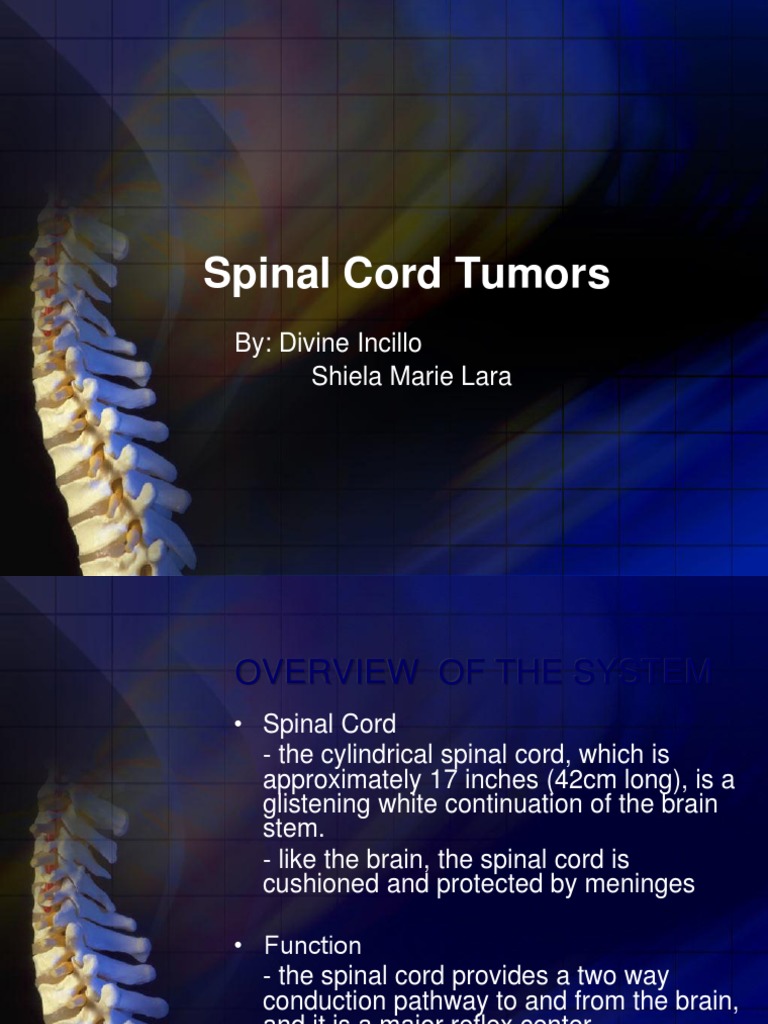 Spinal Cord Tumors Vertebral Column Radiation Therapy
