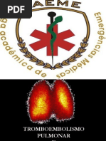 Tromboembolismo Iuri