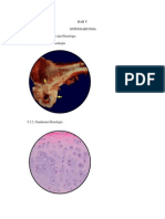 Bab V Osteosarcoma