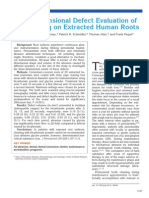 Three-Dimensional Defect Evaluation of Air Polishing On Extracted Human Roots