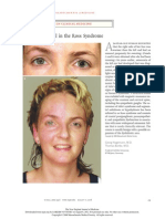 Adie's Pupil in The Ross Syndrome: Images in Clinical Medicine