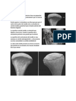 Articulación temporomandibular: anatomía y ligamentos