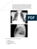 Edema Pulmonar Questoes