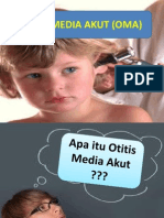 Otitis Media Akut