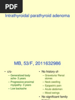 Intrathyroidal Parathyroid Adenoma