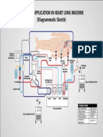 Cytosorb Application in Heart Lung Machine (Diagrammatic Sketch)