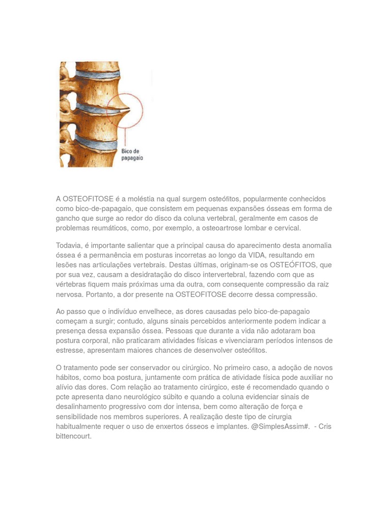 Osteofitose: Causas e Tratamentos | PDF | Coluna vertebral | Dor