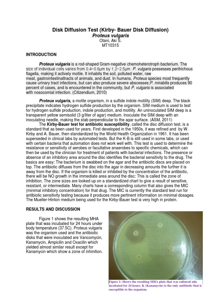 disk-diffusion-test-public-health-microbiology