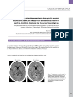 Imagenes Obtenidas Mediante MDCT en Infecciones Del SNC en El Instituto Nacional de Ciencias Neurologicas