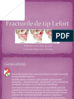 Fracturile de Tip Lefort