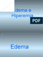 15969115 Edema e Hiperemia