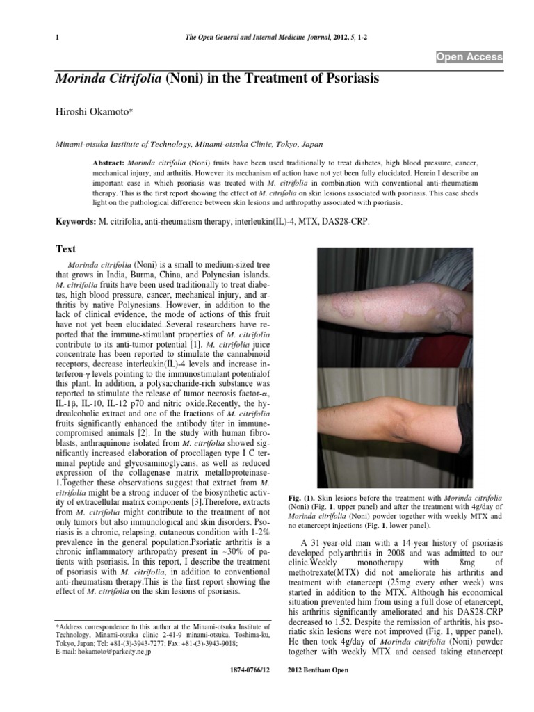 Morinda Citrifolia (Noni) in The Treatment of Psoriasis PDF