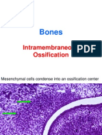 Bones: Intramembraneous Ossification