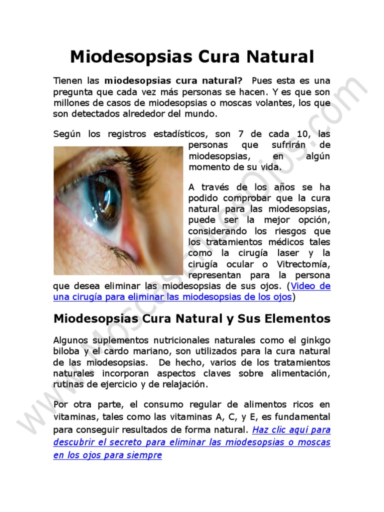 Miodesopsias Cura Natural y Remedios Seguros: Tienen Las Miodesopsias ...