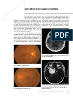 A Patient With Monocular Visual Loss: Pictorial Medicine