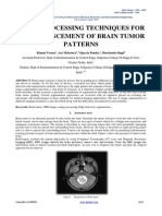 Brain tumor research