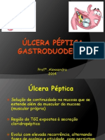 Úlcera Péptica: Causas, Diagnóstico e Tratamento