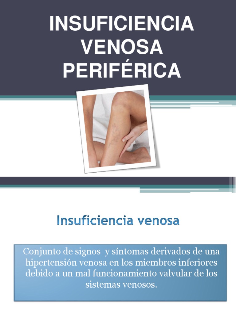 Insuficiencia venosa periférica Venas varicosas Vena