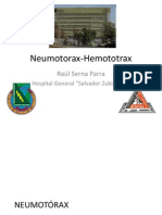 Neumotorax-Hemototrax