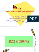 Ecg - Ecg DR Djellaoudji