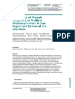 Recurrence of Mycosis Fungoides On Multiple Melanocytic Nevi: A Case Report and Review of The Literature