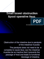 Small Bowel Obstruction Vs Ileus
