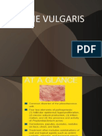 Acne Vulgaris