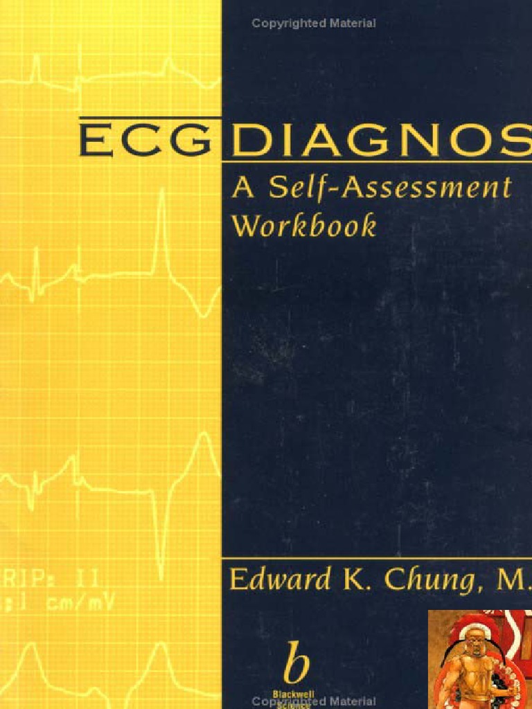 ecg