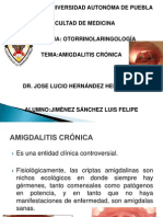 Amigdalitis Crónica