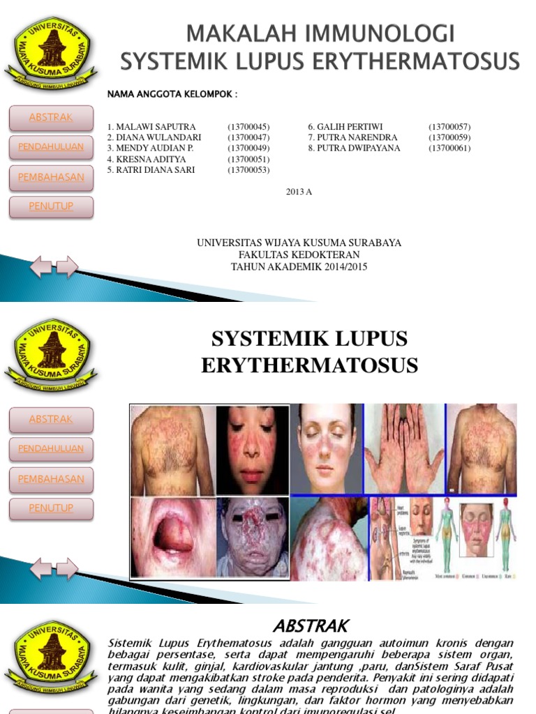 Sle Pdf