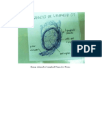 Human Adenoid or Lymphoid Connective Tissue