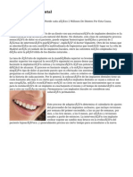 Precio Implante Dental