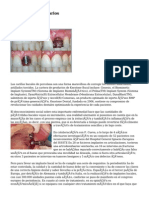 Los Implantes Dentarios