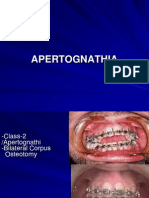 Orthognatic Surgery 2